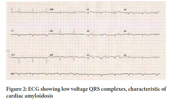 SRP-low-voltage