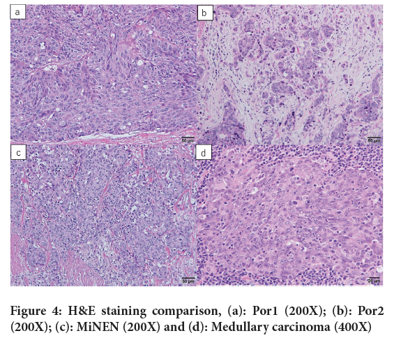 Medullary