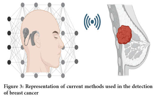 detection