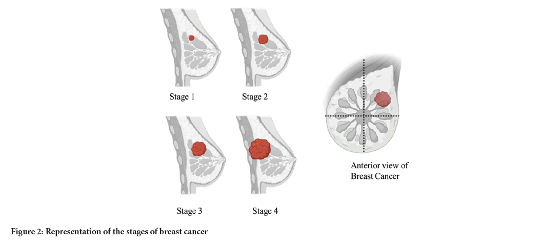 stages